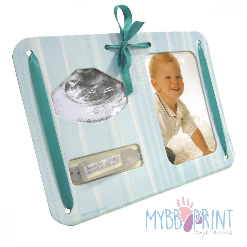 MybbPrint 3 az 1-ben képkeret világoskék – ultrahang kép, fénykép és kórházi karkötő tartó